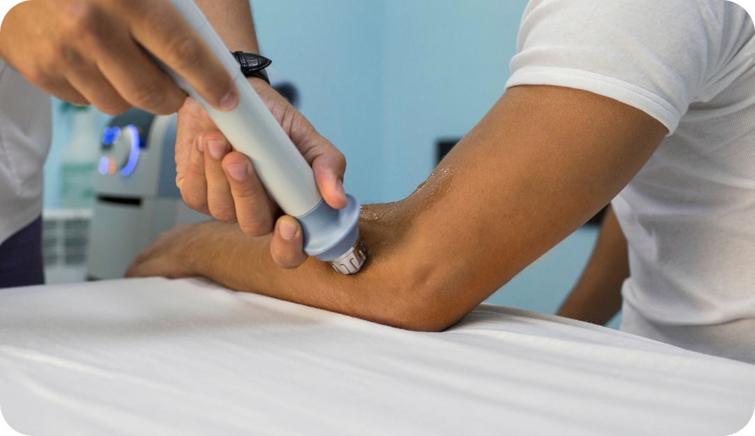 체외충격파 치료